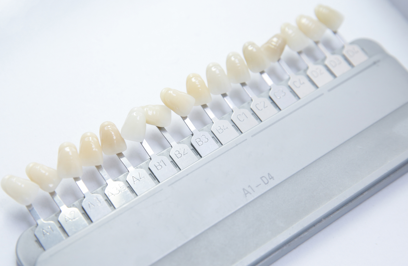 ホワイトニング（オフィス・ホーム）